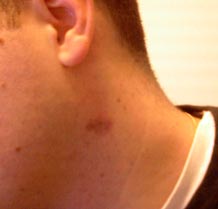 Un suçon dans mon cou